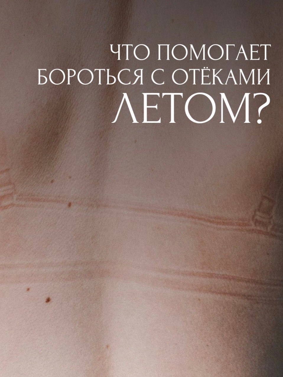 Что помогает бороться летом с отёками?